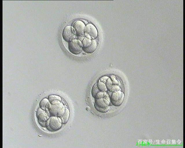 亲子鉴定