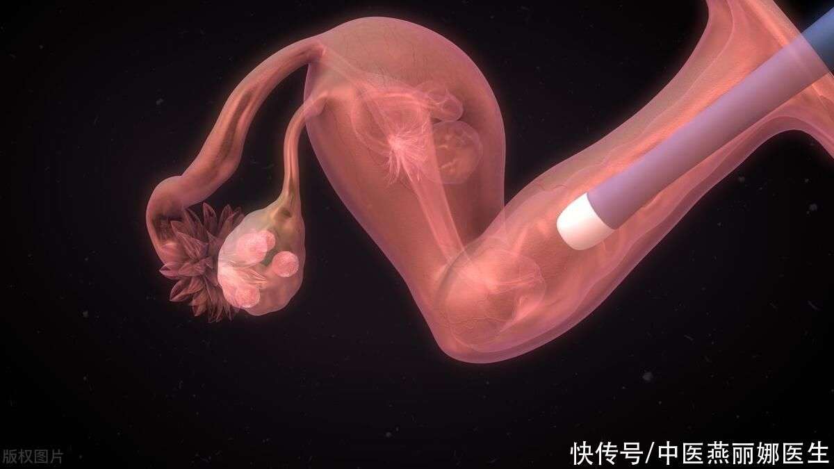 亲子鉴定