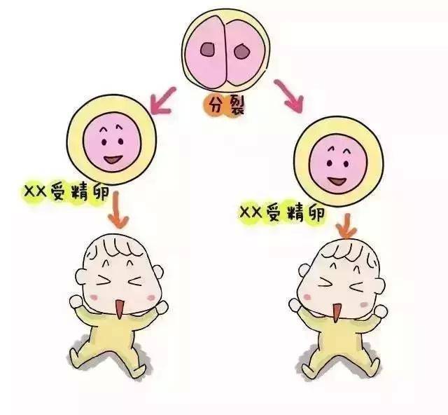产前诊断