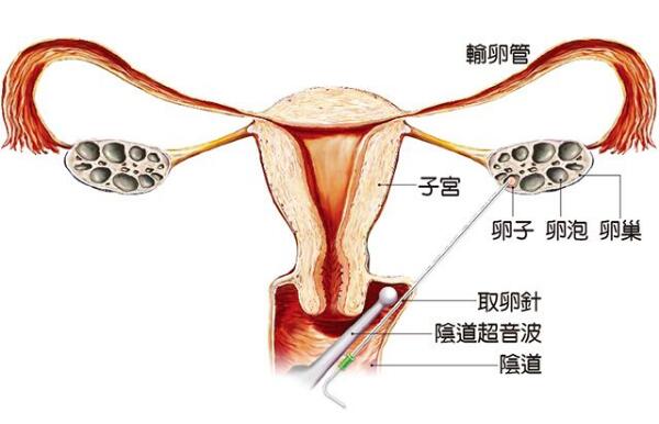 生男生女计算