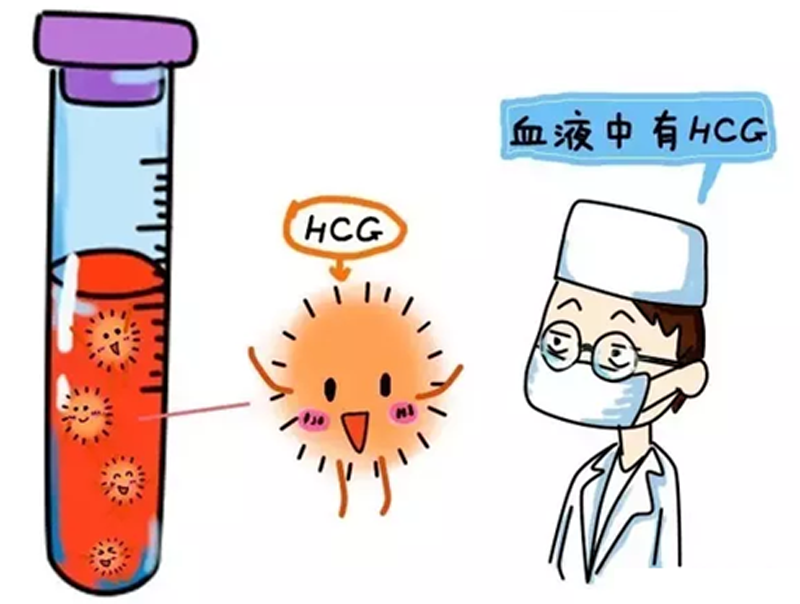 试管婴儿