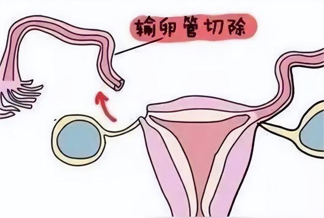 亲子鉴定